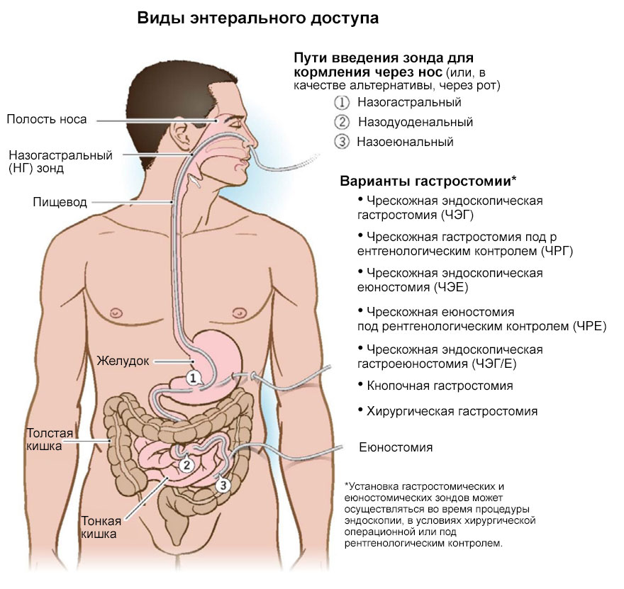 Виды энтерального доступа